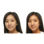 Ab-29247.webp