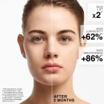 Ab-33187.webp